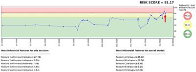 Evaluation of a clinical decision support system for detection of patients at risk after kidney transplantation